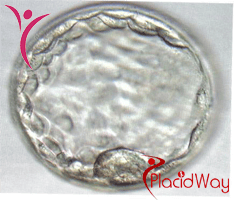 Slider image (4) Main Line Fertility Center